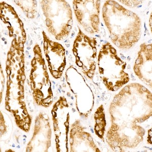 KD-Validated DBT Rabbit mAb (20 μl)