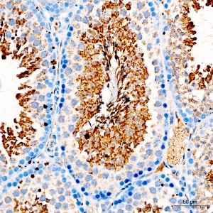 KD-Validated GPX4 Rabbit mAb (20 μl)