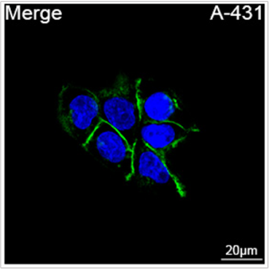 ABflo® 488 Rabbit anti-Human CD104/Integrin β4 mAb (100 T)