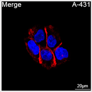 ABflo® 594 Rabbit anti-Human CD104/Integrin β4 mAb (100 T)
