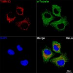 KD-Validated TIMM13 Rabbit mAb (20 μl)