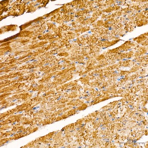 KD-Validated HADHB Rabbit mAb (20 μl)