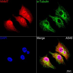 KD-Validated NNMT Rabbit mAb (20 μl)