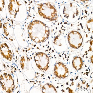 KD-Validated SRP72 Rabbit mAb (20 μl)