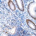 KO-Validated MLH1 Rabbit mAb (20 μl)