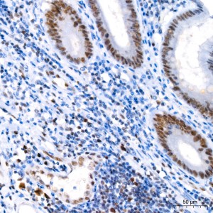 KO-Validated MLH1 Rabbit mAb (20 μl)