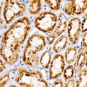KO-Validated LAMP2 Rabbit mAb (20 μl)