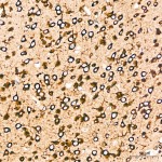 KO-Validated SND1 Rabbit mAb (20 μl)