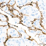 KD-Validated Annexin A1/ANXA1 Rabbit mAb (20 μl)