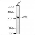 KD-Validated AARS2 Rabbit pAb (20 μl)