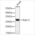 KO-Validated Rab12 Rabbit mAb (20 μl)