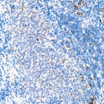 KD-Validated MRPL20 Rabbit mAb (20 μl)