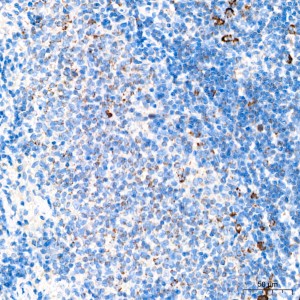 KD-Validated MRPL20 Rabbit mAb (20 μl)