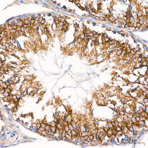 KD-Validated VDAC3 Rabbit mAb (20 μl)