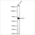 KD-Validated ETV1 Rabbit mAb (20 μl)