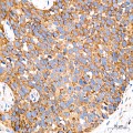KD-Validated HSP90B1 Rabbit mAb (20 μl)
