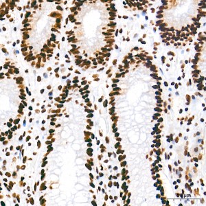 KO-Validated HDAC1 Rabbit mAb (20 μl)