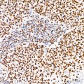KD-Validated CREBBP Rabbit mAb (20 μl)