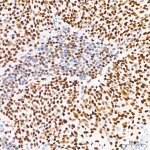 KD-Validated CREBBP Rabbit mAb (20 μl)