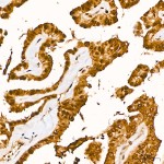 KD-Validated METTL3 Rabbit mAb (20 μl)