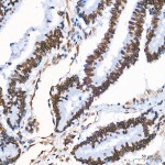 KO-Validated Lamin A/C Mouse mAb (20 μl)