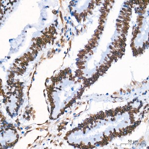 KO-Validated Lamin A/C Mouse mAb (20 μl)