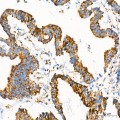 KD-Validated ETFDH Rabbit mAb (20 μl)