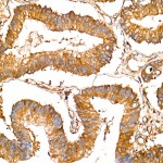 KD-Validated LAP3 Rabbit mAb (20 μl)