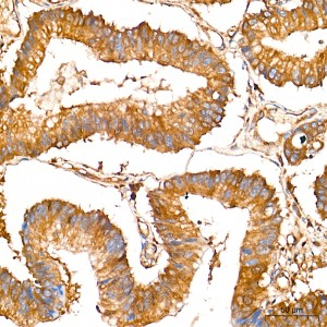 KD-Validated LAP3 Rabbit mAb (20 μl)