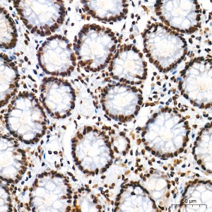 KD-Validated hnRNP A2B1 Rabbit mAb (20 μl)