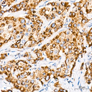 KD-Validated CHCHD4 Rabbit mAb (20 μl)