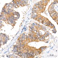 KD-Validated MCT1 Rabbit mAb (20 μl)