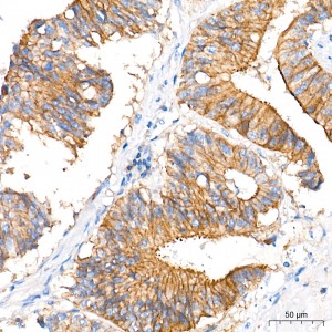 KD-Validated MCT1 Rabbit mAb (20 μl)