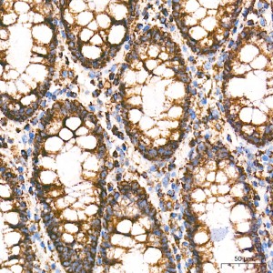 KD-Validated ECHS1 Rabbit mAb (20 μl)