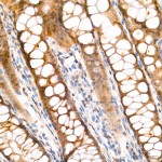 KO-Validated HIF1AN/FIH-1 Rabbit mAb (20 μl)
