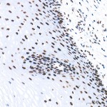 KD-Validated FOXK1 Rabbit mAb (20 μl)