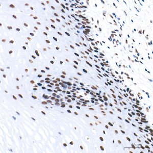 KD-Validated FOXK1 Rabbit mAb (20 μl)