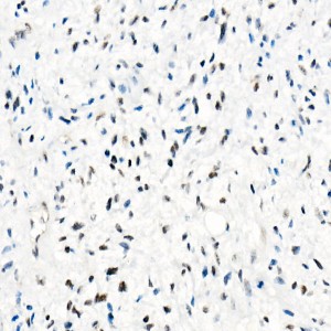 KO-Validated SMARCB1/SNF5 Rabbit mAb (20 μl)