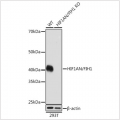 KO-Validated HIF1AN/FIH1 Rabbit mAb (20 μl)