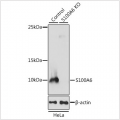 KO-Validated S100A6 Rabbit pAb (20 μl)