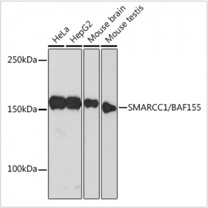 KO-Validated SMARCC1/BAF155 Rabbit mAb (20 μl)