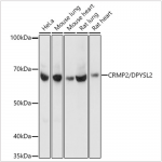 KO-Validated CRMP2/DPYSL2 Rabbit mAb (20 μl)