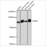 KO-Validated GRK2 Rabbit mAb (20 μl)