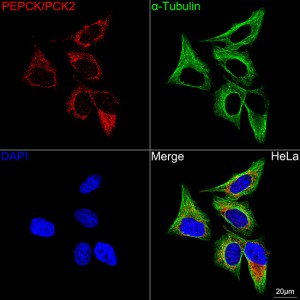 KO-Validated PEPCK/PCK2 Rabbit mAb (20 μl)