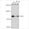 KO-Validated MTA2 Rabbit mAb (20 μl)