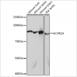 KO-Validated ACVR2A Rabbit mAb (20 μl)