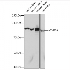 KO-Validated ACVR2A Rabbit mAb (20 μl)