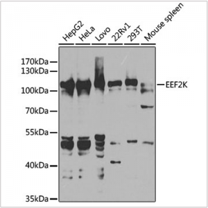 KO-Validated EEF2K Rabbit pAb (20 μl)