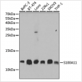 KO-Validated S100A11 Rabbit pAb (20 μl)