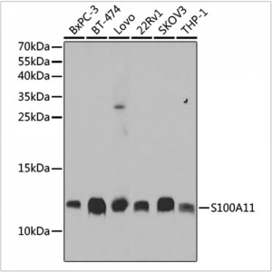 KO-Validated S100A11 Rabbit pAb (20 μl)